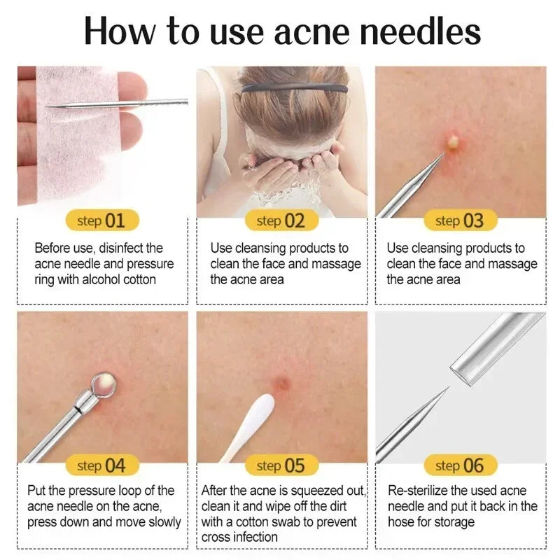 11Pcs Acne Pimple / Blackhead Remover