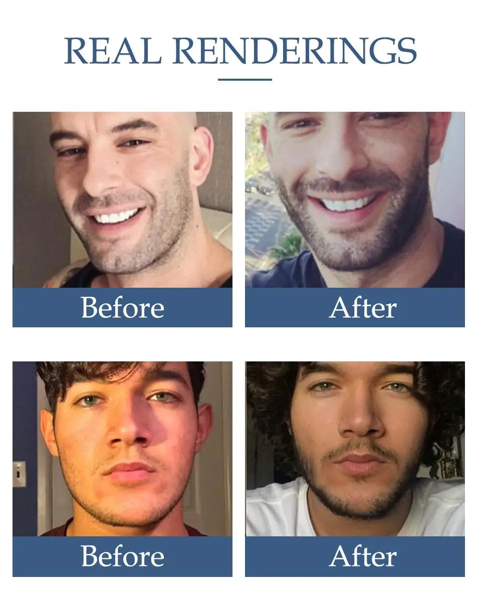 Men Natural Beard Growth Oil